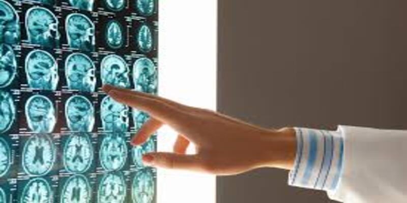 Brain Injury INDIVIDUAL Software
